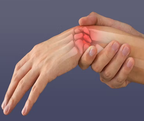 Broken or Fractured Arm/Wrist/Hand care