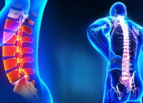  Spine Treatment